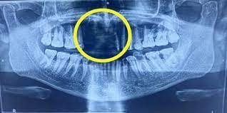General Surgery