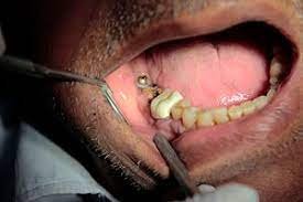 General Surgery